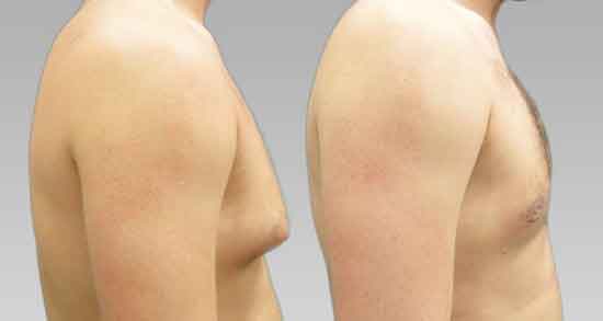تعبیر خواب بوسیدن سینه