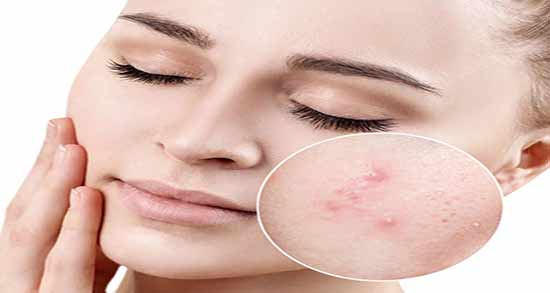 فواید تخمه شربتی برای پوست ؛ خواص تخمه شربتی و خاکشیر برای کودکان