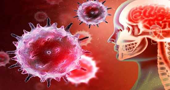 مننژیت ؛ بررسی یکی از شایع ترین بیماریهای مغز و اعصاب به نام مننژیت