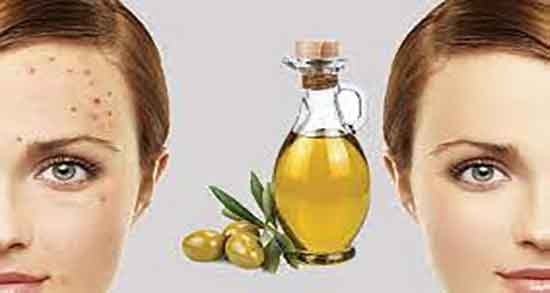روغن زیتون برای مو ؛ ماسک روغن زیتون برای مو چه فایده ای دارد