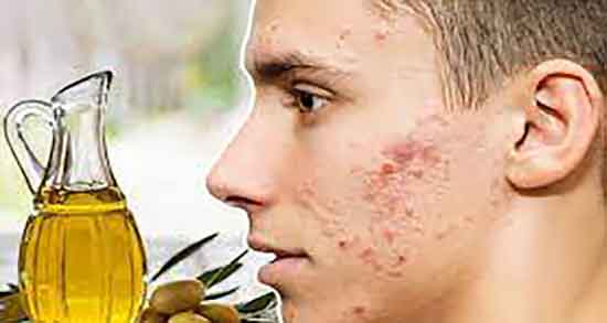 روغن زیتون و کندر برای ترک پوست ؛ طرز تهیه روغن زیتون و کندر برای پا