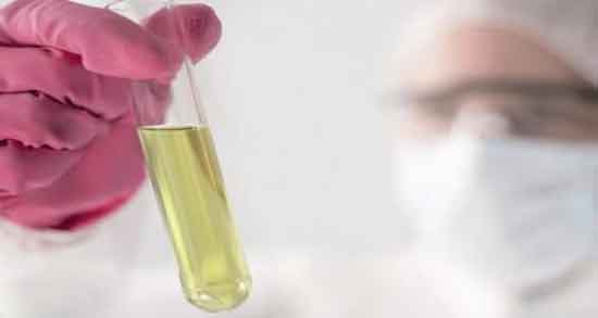 ادرار انسان در عطر ؛ آیا برای ساخت عطرهای تقلبی از ادرار انسان استفاده می کنند؟