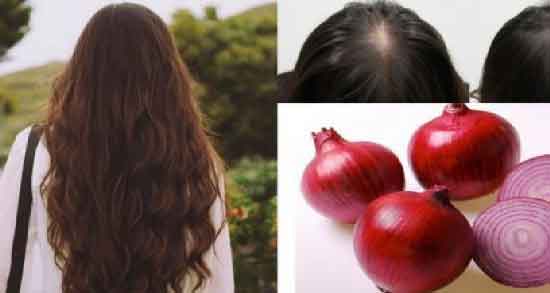 آب پیاز برای رشد مو ؛ آشنایی با خواص آب پیاز برای افزایش رشد مو