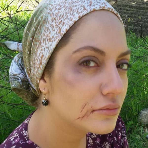 کتک خوردن مهناز افشار عکس مهناز افشار و گوگوش عکس مهناز افشار عکس عروسی مهناز افشار واقعی مهناز افشار الان کجاست علت فرار مهناز افشار از ایران پدر مهناز افشار اهل کجاست مهناز افشار درگذشت مادر مهناز افشار کیست