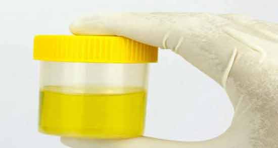 تعبیر خواب بوی ادرار ، معنی بوی ادرار در خواب های ما چیست
