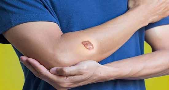 تعبیر خواب گوشت اضافه در بدن ، معنی گوشت اضافه در بدن در خواب های ما چیست