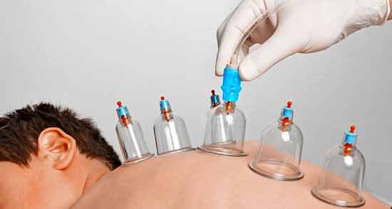 عوارض حجامت ؛ همه چیز درباره عوارض حجامت کردن