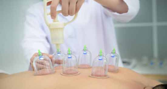 مضرات حجامت کمر ؛ همه چیز درباره مضرات حجامت کردن کمر