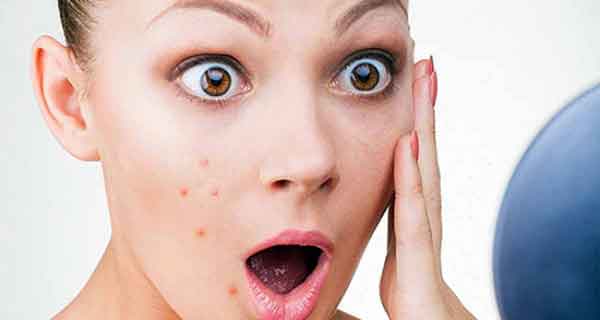 تعبیر خواب جوش صورت از نظر امام صادق و جوش های بزرگ و چرکی روی بدن