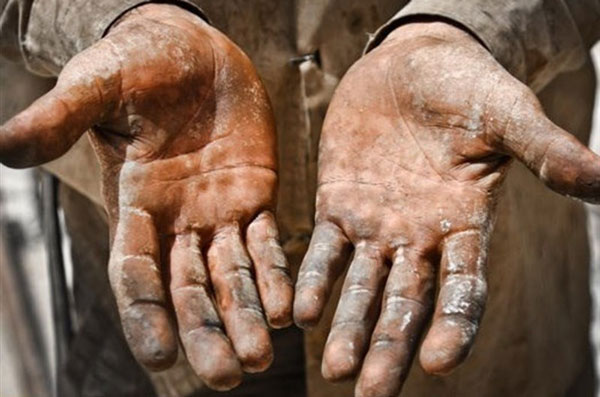 تعبیر خواب دست سیاه + معنی دست سیاه در خواب های ما چیست